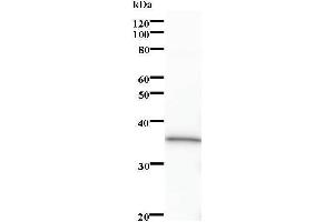 Western Blotting (WB) image for anti-Cyclin M3 (CNNM3) antibody (ABIN931242)