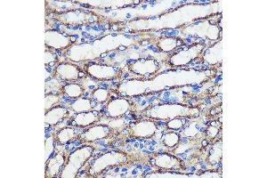 Immunohistochemistry (IHC) image for anti-Staphylococcal Nuclease Domain Containing Protein 1 (SND1) (AA 26-285) antibody (ABIN6148197)