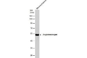 AGT Antikörper