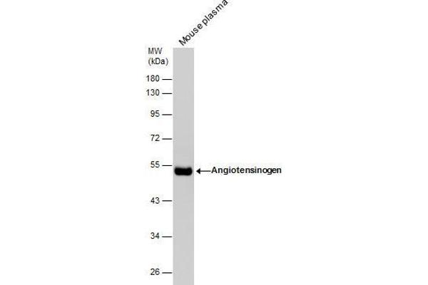 AGT Antikörper