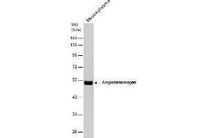 WB Image Mouse tissue extract (50 μg) was separated by 10% SDS-PAGE, and the membrane was blotted with Angiotensinogen antibody [N1C3] , diluted at 1:1000. (AGT Antikörper)