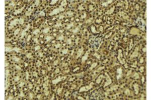 ABIN6277519 at 1/100 staining Mouse kidney tissue by IHC-P. (PRKACB Antikörper  (C-Term))