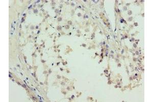 Immunohistochemistry of paraffin-embedded human testis tissue using ABIN7158010 at dilution of 1:100 (L3MBTL4 Antikörper  (AA 1-270))
