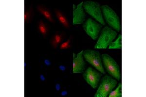 ABIN6257451 and ABIN6273495 staining  cells by IF/ICC.