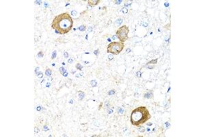 Immunohistochemistry (IHC) image for anti-Neuregulin 4 (NRG4) (AA 1-115) antibody (ABIN3016310)