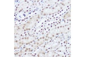 Immunohistochemistry of paraffin-embedded mouse kidney using S Rabbit pAb (ABIN6132631, ABIN6147390, ABIN6147391 and ABIN6224669) at dilution of 1:100 (40x lens). (SART1 Antikörper  (AA 1-255))
