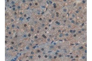 Figure. (RNASE4 Antikörper  (AA 30-147))