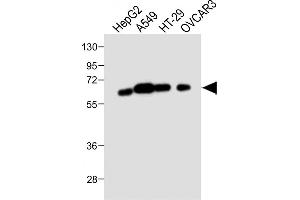 All lanes : Anti-CYP3A4 Antibody (Center) at 1:1000 dilution Lane 1: HepG2 whole cell lysate Lane 2: A549 whole cell lysate Lane 3: HT-29 whole cell lysate Lane 4: OVCAR3 whole cell lysate Lysates/proteins at 20 μg per lane. (CYP3A4 Antikörper  (AA 228-255))