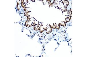 Immunohistochemistry of paraffin-embedded rat lung using FOX Rabbit pAb (5278) at dilution of 1:100 (40x lens).