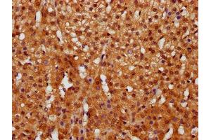IHC image of ABIN7153551 diluted at 1:400 and staining in paraffin-embedded human adrenal gland tissue performed on a Leica BondTM system.