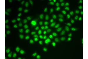 Immunofluorescence analysis of HeLa cells using SMARCE1 antibody. (SMARCE1 Antikörper)