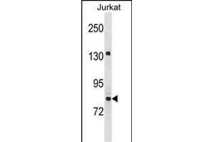 UHRF2 Antibody (Center) (ABIN1538450 and ABIN2850120) western blot analysis in Jurkat cell line lysates (35 μg/lane). (UHRF2 Antikörper  (AA 479-508))