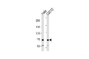 Western Blotting (WB) image for anti-Succinate Dehydrogenase Complex, Subunit A, Flavoprotein (Fp) (SDHA) (AA 577-605), (C-Term) antibody (ABIN1881780)