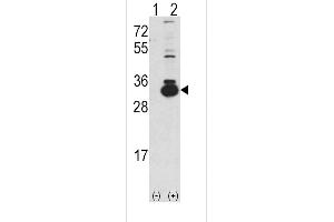 Western blot analysis of KHK using rabbit polyclonal Ketohexokinase (KHK) Antibody using 293 cell lysates (2 ug/lane) either nontransfected (Lane 1) or transiently transfected with the KHK gene (Lane 2). (Ketohexokinase Antikörper  (C-Term))