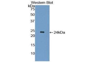Western Blotting (WB) image for anti-Interleukin 1 Receptor Antagonist (IL1RN) (AA 26-176) antibody (ABIN1172590) (IL1RN Antikörper  (AA 26-176))