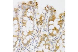 Immunohistochemistry of paraffin-embedded human rectum using MYO5A antibody (ABIN6003562) at dilution of 1/100 (40x lens). (MYO5A Antikörper)