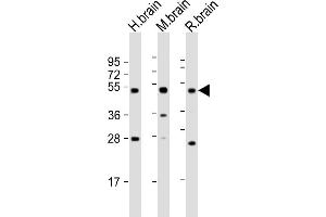 All lanes : Anti-NPTX1 Antibody at 1:2000 dilution Lane 1: human brain lysate Lane 2: mouse brain lysate Lane 3: rat brain lysate Lysates/proteins at 20 μg per lane.