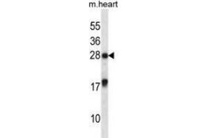 Western blot analysis in mouse heart tissue lysates (35ug/lane) using MXI1 Antibody .