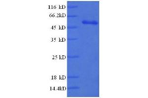 CD3e Molecule, epsilon (CD3-TCR Complex) (CD3E) (AA 23-207), (full length) protein (GST tag) (CD3 epsilon Protein (CD3E) (AA 23-207, full length) (GST tag))