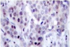 Image no. 2 for anti-Nuclear Factor of kappa Light Polypeptide Gene Enhancer in B-Cells 2 (NFKB2) (pSer865) antibody (ABIN318076)