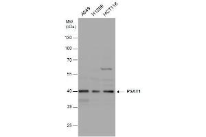 WB Image PSAT1 antibody [N1C3] detects PSAT1 protein by western blot analysis.