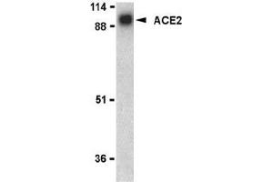 Western blot analysis of ACE2 in human kidney lysate with AP30008PU-N ACE2 antibody at 1 μg/ml. (ACE2 Antikörper  (N-Term))