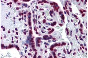 Immunohistochemistry (Formalin-fixed Paraffin-embedded Sections) (IHC (fp)) image for anti-Splicing Factor 1 (SF1) (AA 1-111) antibody (ABIN574390)
