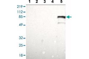 Western blot analysis of Lane 1: RT-4 cell lysate, Lane 2: U-251 MG sp cell lysate, Lane 3: A-431 cell lysate, Lane 4: Human liver tissue, Lane 5: Human tonsil tissue with BTK polyclonal antibody  at 1:100 - 1:250 dilution. (BTK Antikörper  (AA 206-351))