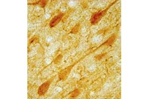 IHC image of neurons in rat cortex.