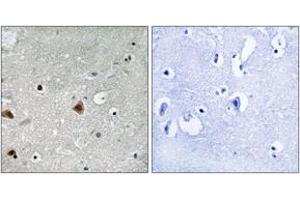 Immunohistochemistry analysis of paraffin-embedded human brain, using COPS1 (Phospho-Ser454) Antibody. (GPS1 Antikörper  (pSer454))
