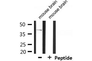 Western blot analysis of extracts from mouse brain, using CD2 Tail-binding Antibody. (CD2BP2 Antikörper  (Internal Region))