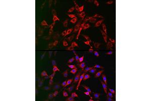 Immunofluorescence analysis of NIH/3T3 cells using LRP5 Rabbit pAb (ABIN1513164, ABIN3020644, ABIN3020646 and ABIN6213630) at dilution of 1:200 (40x lens). (LRP5 Antikörper  (AA 1000-1250))