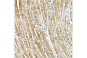 Immunohistochemistry of paraffin-embedded rat heart using DRP1 Rabbit pAb (ABIN3023669, ABIN3023670, ABIN3023671, ABIN1679564 and ABIN6219696) at dilution of 1:250 (40x lens).