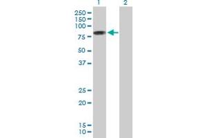 Western Blotting (WB) image for anti-Protein Inhibitor of Activated STAT, 2 (PIAS2) (AA 1-572) antibody (ABIN522502)