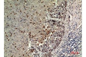 Immunohistochemistry (IHC) image for anti-Branched Chain Amino-Acid Transaminase 1, Cytosolic (BCAT1) (Internal Region) antibody (ABIN6282456)