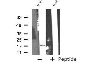 Western blot analysis of extracts from A549 cells, using COX5A antibody. (COX5A Antikörper  (Internal Region))