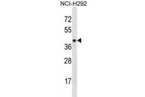 Western Blotting (WB) image for anti-V-Set and Immunoglobulin Domain-Containing Protein 4 (VSIG4) antibody (ABIN3000551)