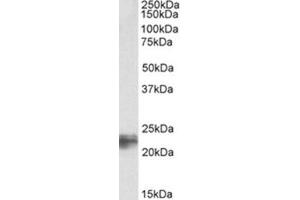 Image no. 1 for anti-Transgelin (TAGLN) (C-Term) antibody (ABIN374407) (Transgelin Antikörper  (C-Term))