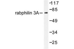 Image no. 1 for anti-Rabphilin 3A (RPH3A) antibody (ABIN272075) (RPH3A Antikörper)
