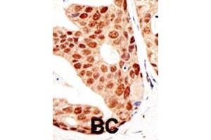 Immunohistochemistry (Paraffin-embedded Sections) (IHC (p)) image for anti-Protein Inhibitor of Activated STAT, 3 (PIAS3) (AA 95-126), (N-Term) antibody (ABIN1882116)