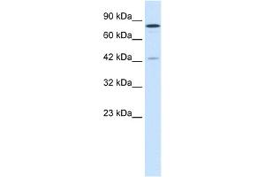 WB Suggested Anti-JMJD1A Antibody Titration:  1. (KDM3A Antikörper  (C-Term))