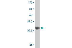 Western Blot detection against Immunogen (37. (ZNF207 Antikörper  (AA 1-110))