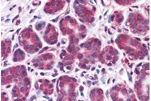 Human Breast: Formalin-Fixed, Paraffin-Embedded (FFPE) (Retinoblastoma Binding Protein 8 Antikörper  (AA 452-747))