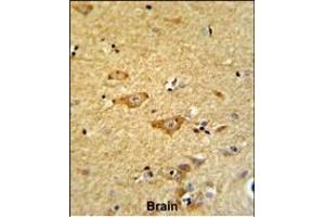 Formalin-fixed and paraffin-embedded human brain reacted with OMD Antibody (Center), which was peroxidase-conjugated to the secondary antibody, followed by DAB staining. (Osteomodulin Antikörper  (AA 234-263))
