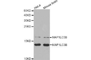 Western Blotting (WB) image for anti-Microtubule-Associated Protein 1 Light Chain 3 beta (MAP1LC3B) antibody (ABIN1876926) (LC3B Antikörper)