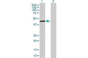 Western Blot analysis of TMEM171 expression in transfected 293T cell line by TMEM171 MaxPab polyclonal antibody. (TMEM171 Antikörper  (AA 1-323))