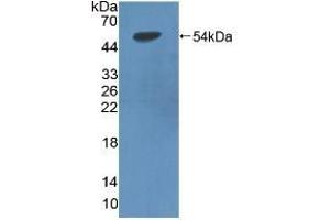 Detection of Recombinant LIPD, Rat using Polyclonal Antibody to Lipoprotein lipase (LPL) (Lipoprotein Lipase Antikörper  (AA 28-474))