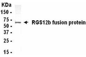 Western Blotting (WB) image for anti-Regulator of G-Protein Signalling 12 (RGS12) (AA 1372-1447) antibody (ABIN2467877)