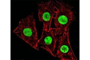 Fluorescent image of C2C12cells stained with Hmga2 antibody at 1:25 dilution.