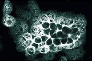 Immunofluorescence staining of A431 cells (ALOX5 Antikörper  (AA 442-590))